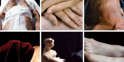 différents portraits extraits de la série The Morgue d'andres serrano